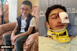 مرکز حقوق بی بشر رژیم صهیونیستی گزارش می دهد؛

بتسلیم: در سال 2019 نظامیان اسرائیلی به چشمان 21 فلسطینی آسیب زدند/ سکوت در مراکز حقوقی آمریکا