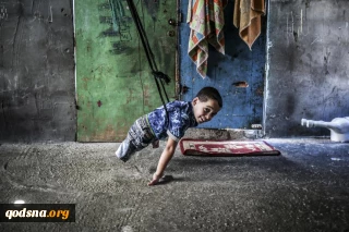 گزارش تکان دهنده وزارت بهداشت فلسطین از تعداد قطع عضو در نوار غزه/ چهار هزار و ۵۰۰ مورد قطع عضو