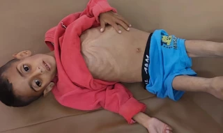 GMO: 66 Palestinian children die of malnutrition in Gaza
