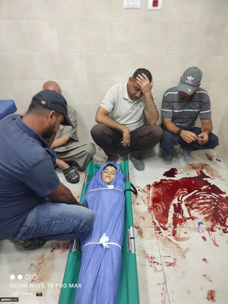 یک صبح خونین دیگر در غزه؛ وداع با ده‌ها شهید در بیمارستان العوده در پی دور جدید حملات هوایی رژیم صهیونیستی
 7