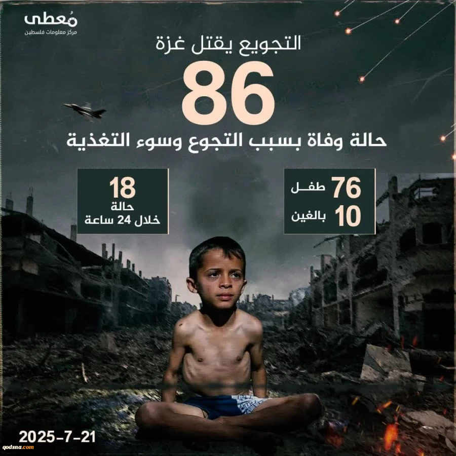 با شهادت 18 نفر در یک روز؛ 86 فلسطینی قربانی گرسنگی در قتلگاه غزه شدند
 2