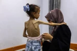 شهادت 5 نفر دیگر در اثر سوء تغذیه در نوار غزه 2