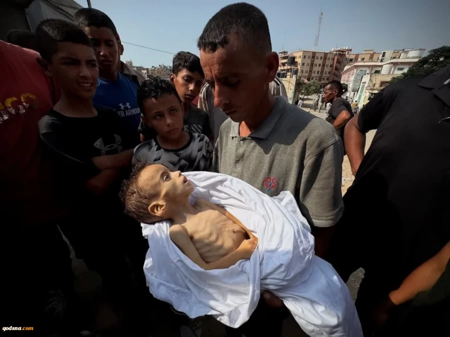 شهادت ۲۲۷ نفر در غزه به دلیل گرسنگی و سوء تغذیه 2