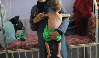 UNICEF: 112 Gazan children diagnosed with acute malnutrition every day