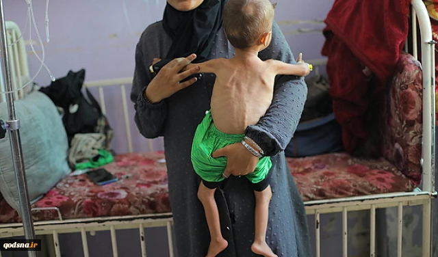 UNICEF: 112 Gazan children diagnosed with acute malnutrition every day