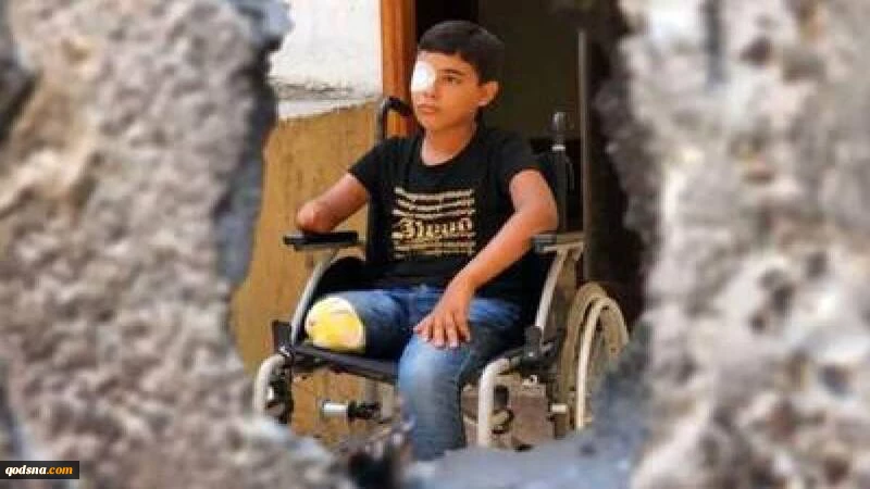روزانه ۳۰ نفر براثر حملات رژیم صهیونیستی در غزه معلول می شوند 2