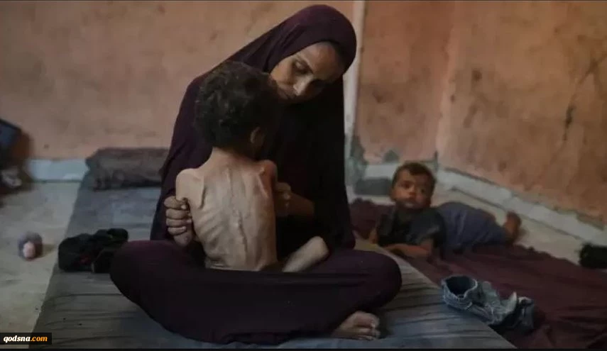 "الأونروا": طفل من كل 3 أطفال في غزة يعاني من سوء التغذية 2