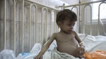آنروا: از هر ۳ کودک، یک کودک در غزه طی ۲۴ ساعت گذشته هیچ غذایی دریافت نکرده است 2
