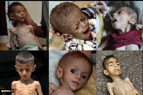 وزارت بهداشت غزه خواستار نجات نظام درمانی شد/ بیماران در انتظار درمان جان می‌دهند 2