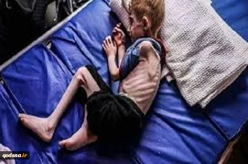 یونیسف: سوء تغذیه و آغاز زمستان جان کودکان در غزه را تهدید می‌کند 2