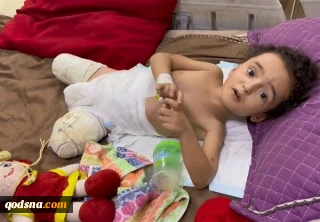 قطع عضو در غزه ۲۲۵ درصد افزایش یافت