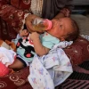 بیش از ۹۹ هزار کودک و زن باردار و شیرده در غزه در معرض سوءتغذیه حاد قرار دارند