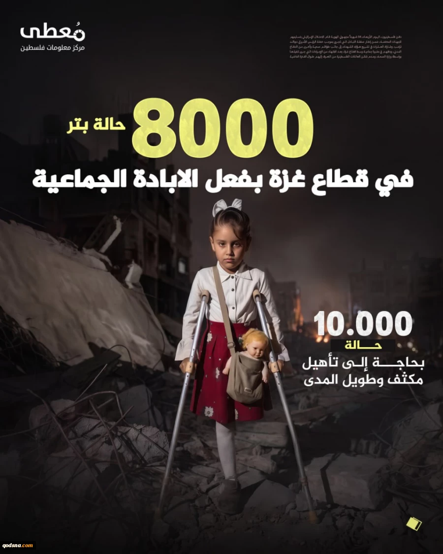 8000  قطع عضو از ابتدای جنگ علیه غزه+عکس 2